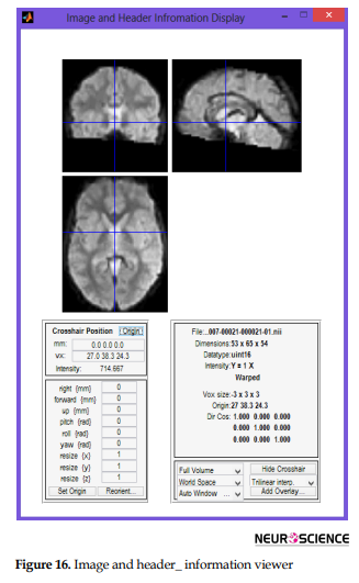Integrated MATLAB Toolbox for fMRI Visualization and Data Conversion ...