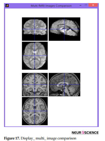 Integrated MATLAB Toolbox for fMRI Visualization and Data Conversion ...