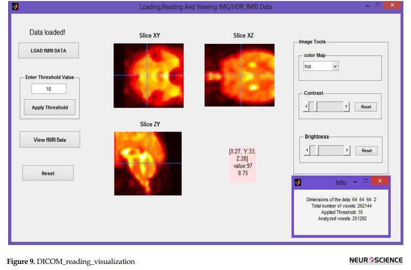 Integrated MATLAB Toolbox for fMRI Visualization and Data Conversion ...